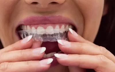 Invisalign Riverside: Clear Aligner Therapy for Discreet Orthodontic Correction